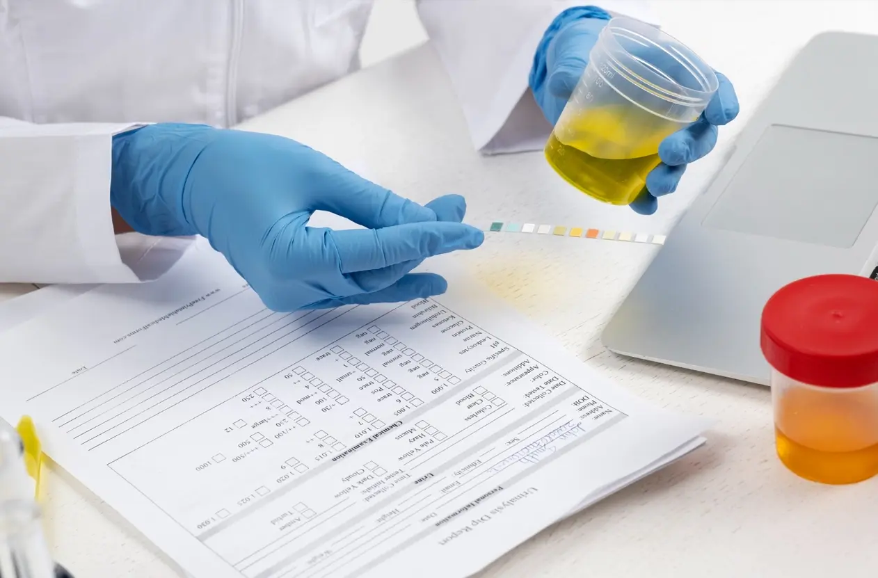 Exame Toxicológico: o que é e como funciona? - Blog BR MED